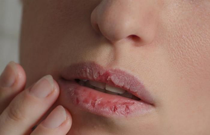 جفاف الفم... هل يمكن اعتباره علامة على مشكلة صحية خطيرة؟