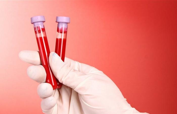 اعتماد أول علاج لأمراض الدم الوراثية