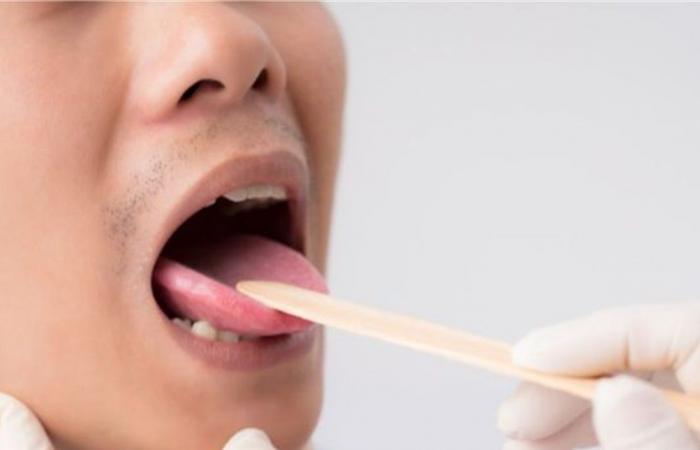 علاج واعد لجفاف الفم واللسان.. ما هو؟