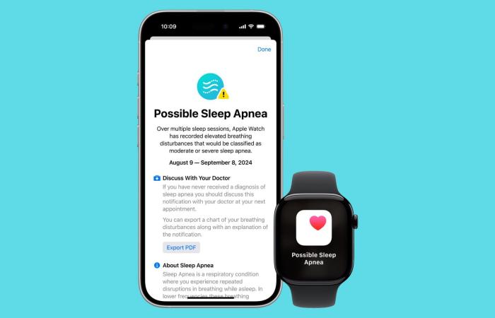 آبل تحصل على موافقة إدارة الغذاء والدواء على ميزة اكتشاف انقطاع النفس أثناء النوم
