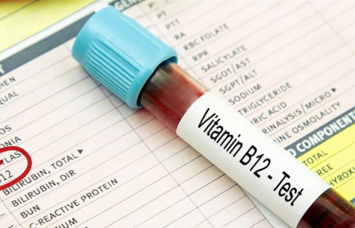 أعراض داخل الفم قد تكون مؤشراً واضحاً على نقص فيتامين B12