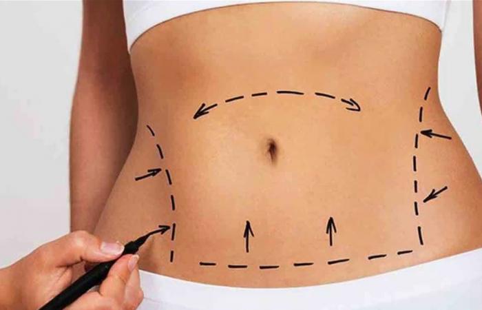 من الدهون إلى القوام المشدود… كيف تطورت عمليات شد البطن؟