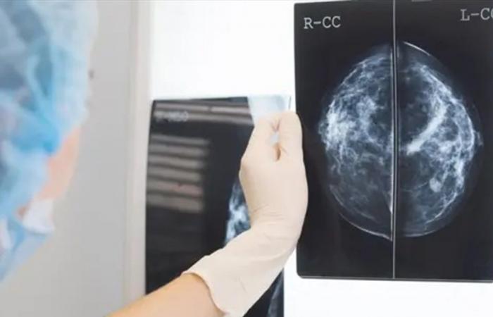 بعد خضوعها لـ 4 سنوات للعلاج الكيميائي.. اكتشفت انها شخصت خطأ بالسرطأن!