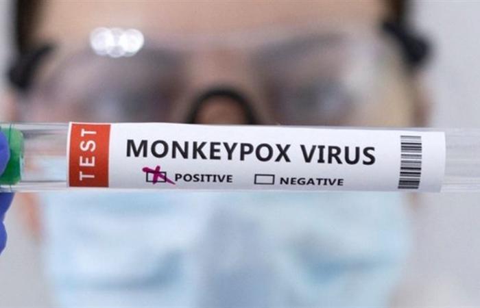 إصابة شخص بالسلالة الأخطر من "جدري القرود" في نيويورك... وهذه أعراض الفيروس