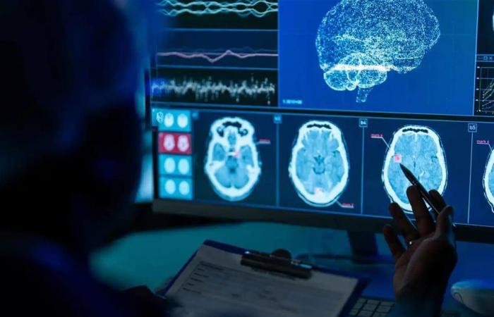 تقنية مغناطيسية جديدة قد تقلّل خطر السكتة الدماغية.. تعرّف إليها