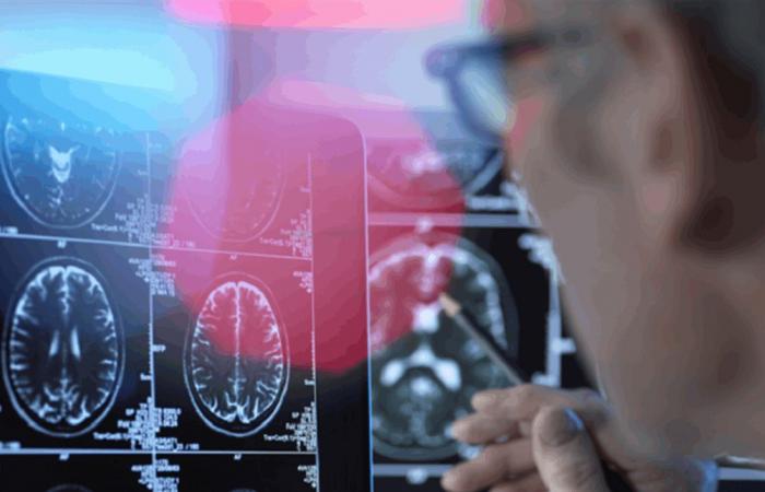 حالة صحية شائعة قد ترتبط بزيادة خطر الخرف