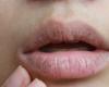ما الذي يسبب جفاف الفم؟
