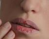 جفاف الفم... هل يمكن اعتباره علامة على مشكلة صحية خطيرة؟