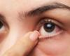 ما هي أسباب جفاف العين وكيف يمكن علاجها؟