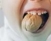 عادات سيئة مدمرة للأسنان... تعرف عليها