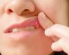 علاج التهاب الفم باستخدام الأدوية